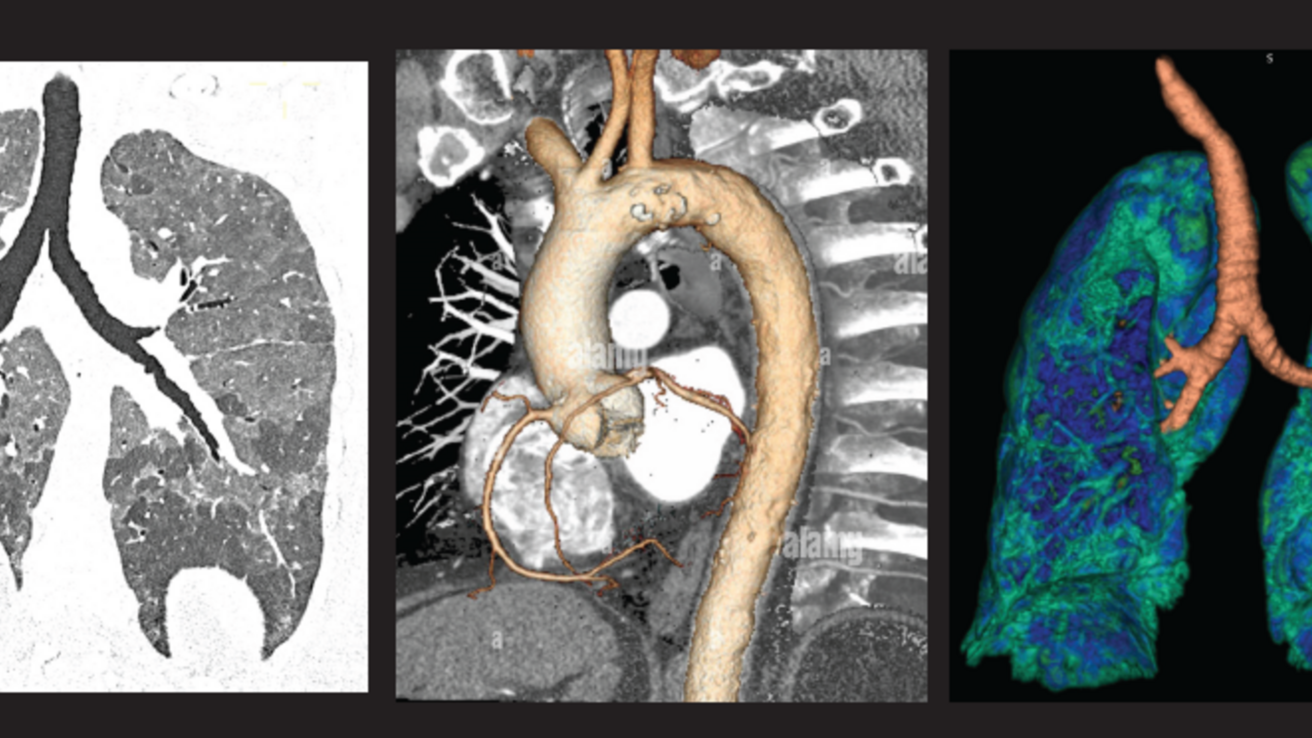 News | Department of Radiology | Carver College of Medicine | The ...